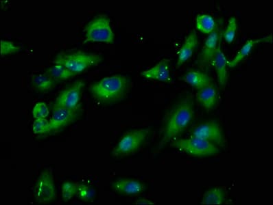 PIK3IP1 / HGFL Antibody