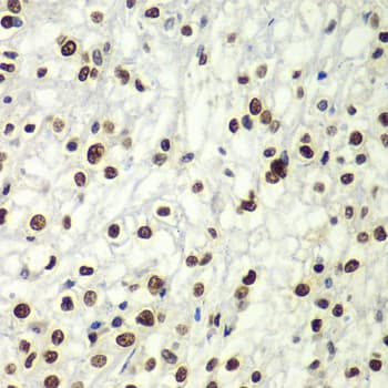 Polyclonal Rabbit anti-Human SF3B2 Antibody (IHC, IF, WB)