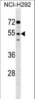 SIRPG Antibody (aa193-221)
