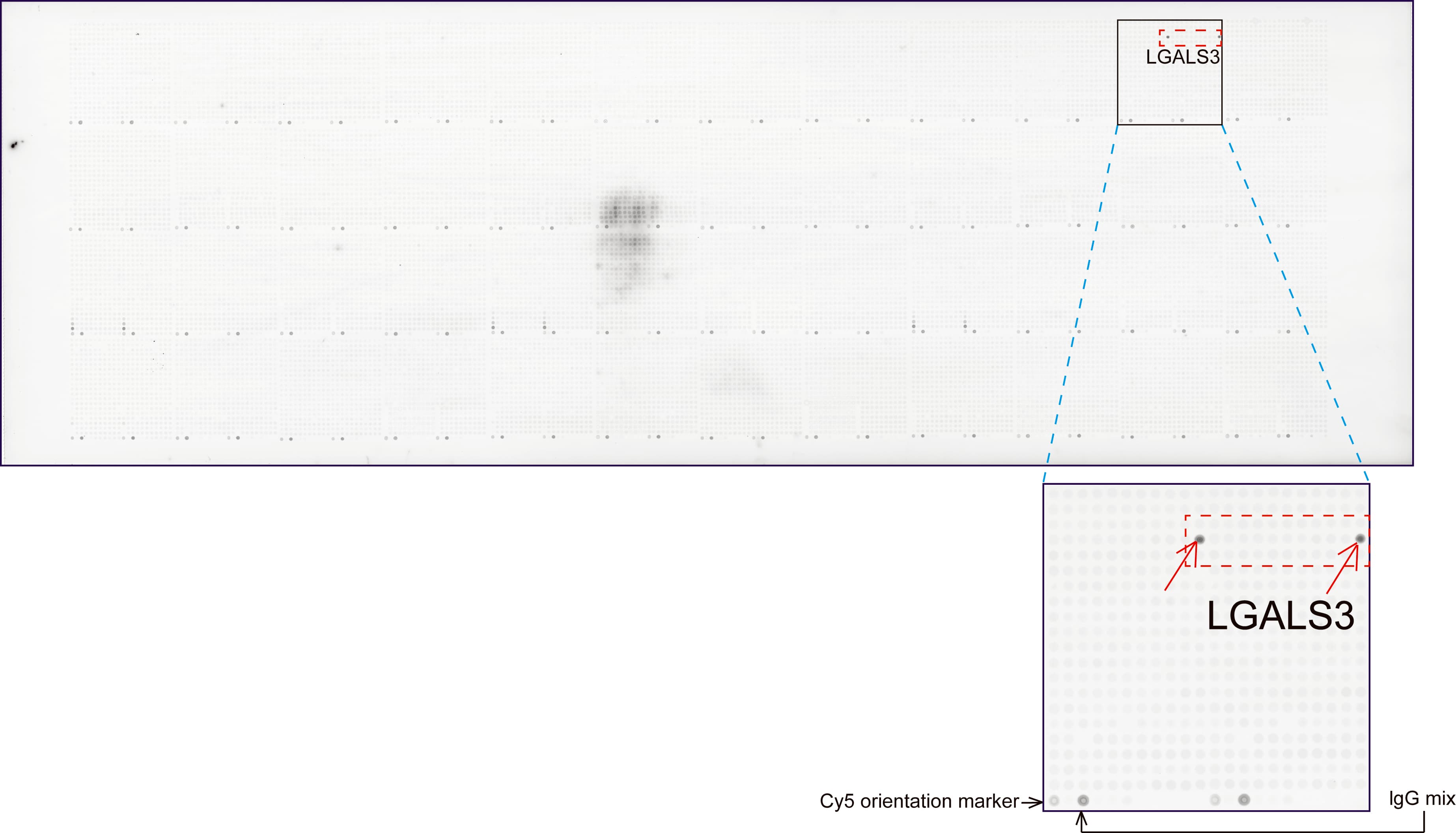 LGALS3 / Galectin 3 Antibody (clone UMAB189)