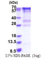 Human RNGTT / HCAP Protein (Recombinant His)