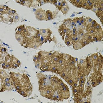 Vimentin Antibody