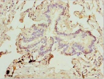 Polyclonal Rabbit anti-Human ZFYVE1 / DFCP1 Antibody (IHC, WB)
