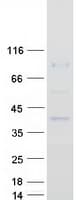 Human PTCD2 Protein (Recombinant Myc-DDK (Flag))