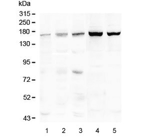 TEK / TIE2 Antibody