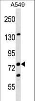 Polyclonal Rabbit anti-Human EPLIN Antibody (aa135-163, WB)