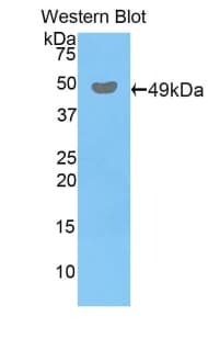 PRDX3 / Peroxiredoxin 3 Antibody (aa64-257)