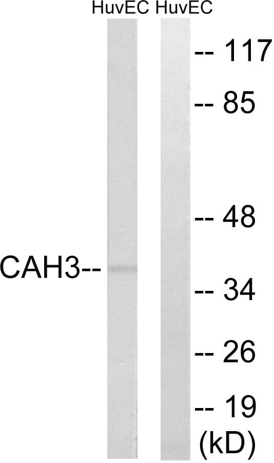 CA3 / Carbonic Anhydrase III Antibody (aa141-190)