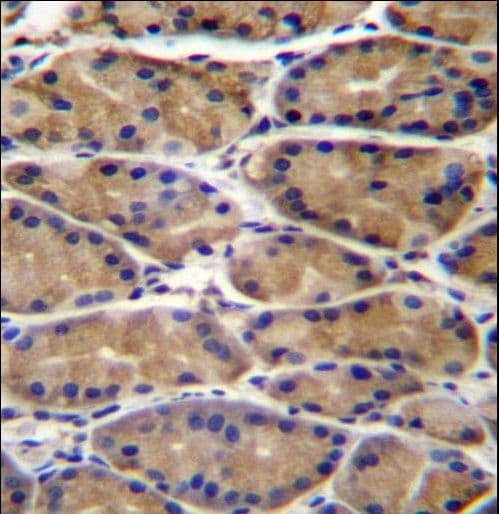 UPRT Antibody (aa204-233)