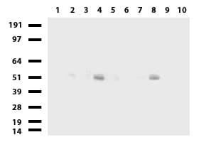 SERPINB4 / SCCA1+2 Antibody (clone UMAB16, Carrier-free)
