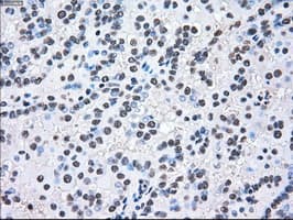 MAP2K2 / MKK2 / MEK2 Antibody (clone OTI8G6)