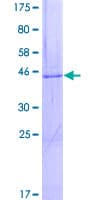 Human DGKE / DGK Epsilon Protein (Recombinant GST)
