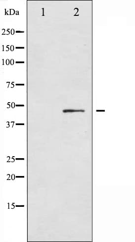 SMAD3 Antibody (phospho-Ser213)