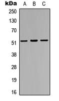 IRX3 Antibody (Internal)