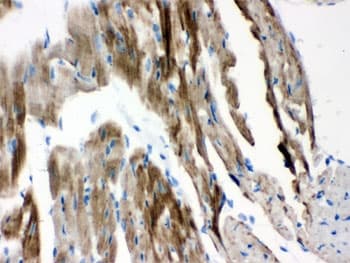 Polyclonal Rabbit anti-Human VDAC1 / PORIN Antibody (aa154-181, IHC, WB)