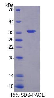 Human CMTM1 Protein (Recombinant His-T7)