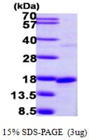 Human SNRPD2 Protein (Recombinant His)