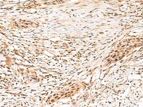 SETMAR Antibody