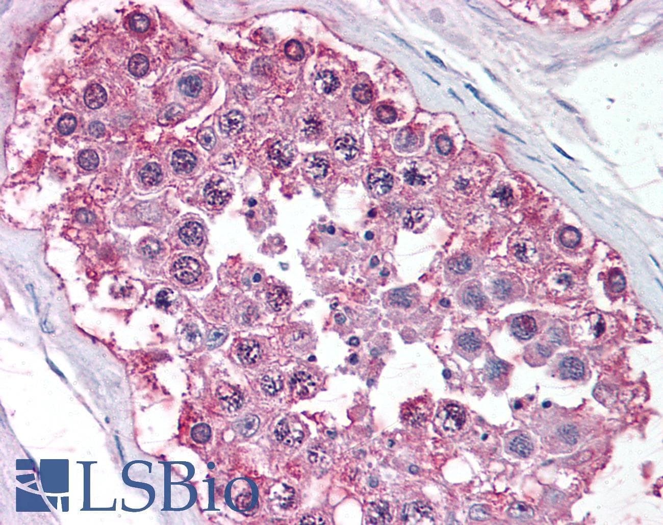 IHC-plus™ Polyclonal Rabbit anti-Human NR0B1 / DAX1 Antibody (Ligand-binding Domain, IHC)