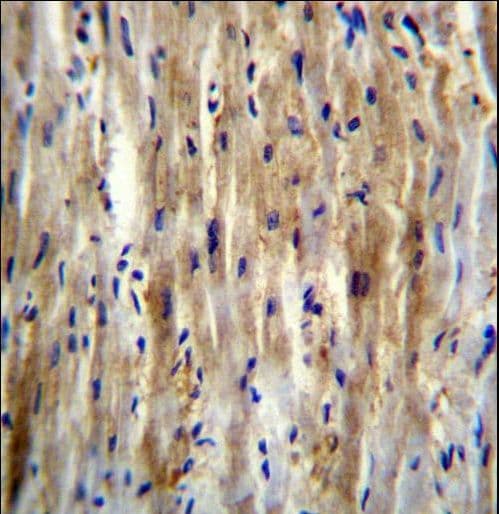 Polyclonal Rabbit anti-Human SLC12A7 / KCC4 Antibody (aa89-117, IHC, WB)