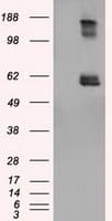 Monoclonal Mouse anti-Human LIPG / Endothelial Lipase Antibody (clone OTI8E4, IHC, IF, WB)