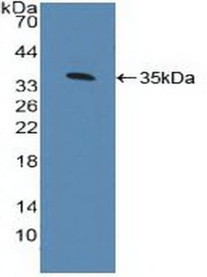 AHR Antibody (aa128-399, APC)