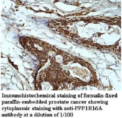 Polyclonal Rabbit anti-Human PPP1R16A Antibody (aa68-188, IHC, WB)
