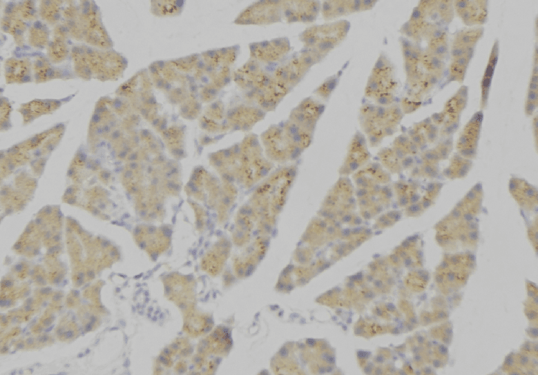 Polyclonal Rabbit anti-Human TNFRSF1B / TNFR2 Antibody (IHC, IF, WB)