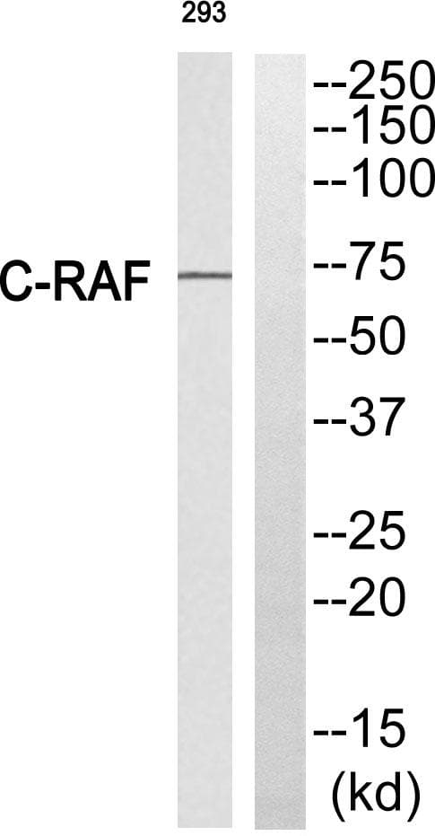 RAF1 / RAF Antibody (p301)
