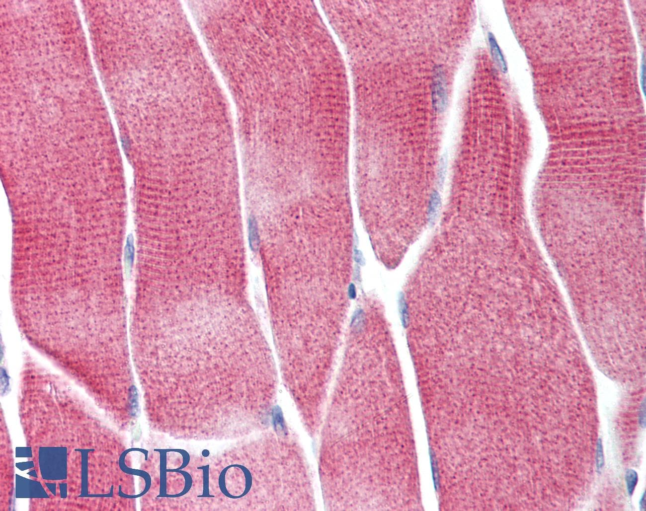 IHC-plus™ AKT1 + AKT2 + AKT3 Antibody (phospho-Ser473)