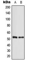 Polyclonal Rabbit anti-Human TP53 / p53 Antibody (N-Terminus, WB)