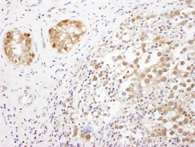 TSNAX / TRAX Antibody (aa240-290)