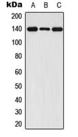 Polyclonal Rabbit anti-Human FGFR1 / FGF Receptor 1 Antibody (phospho-Tyr654, WB)