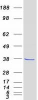 Human FN3K / Fructosamine-3-Kinase Protein (Recombinant Myc-DDK (Flag))