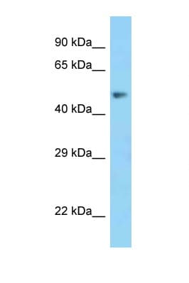 MSR1 / CD204 Antibody (aa85-134)