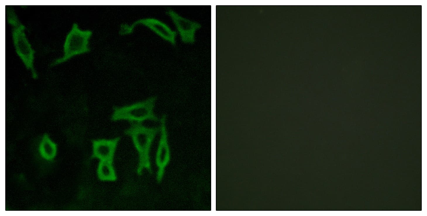 GRM5 / MGLUR5 Antibody (aa21-70)