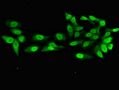 Polyclonal Rabbit anti-Human PRPS2 Antibody (IHC, IF, WB)