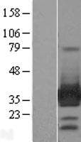 ARH / LDLRAP1 Protein (Over-Expression Lysate Myc-DDK (Flag))