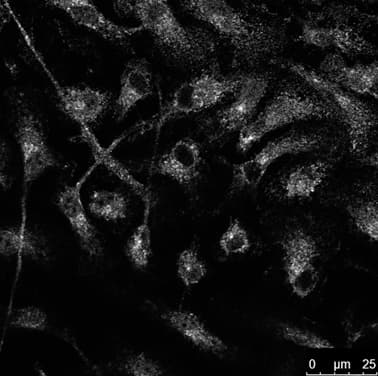 IHC-plus™ Polyclonal Goat anti-Mouse RAB14 Antibody (C-Terminus, IHC, IF, WB)