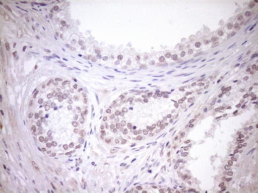 Monoclonal Mouse anti-Human TCP10 Antibody (clone OTI2C2, IHC, WB)