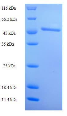 Human ACAA1 Protein (Recombinant His)