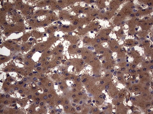KRT7 / CK7 / Cytokeratin 7 Antibody (clone OTI2A2)