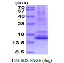 Human NTF4 / Neurotrophin 4 Protein (Recombinant)