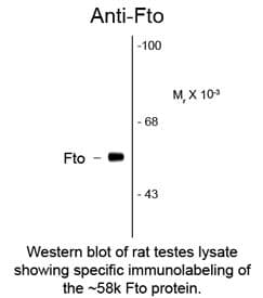 IHC-plus™ FTO Antibody (clone 5-2H10)