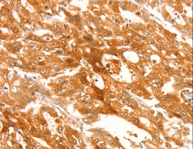 Polyclonal Rabbit anti-Human TRPM7 Antibody (IHC)