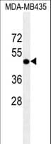 Requiem / DPF2 Antibody