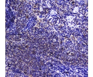 INPP5D / SHIP1 / SHIP Antibody