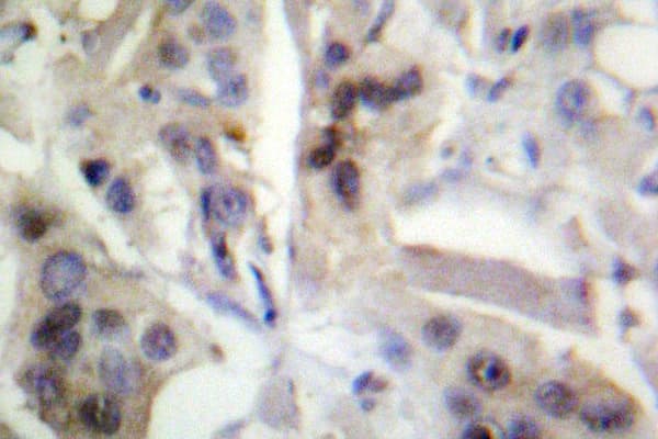 RELA / NFKB p65 Antibody (Lys303)