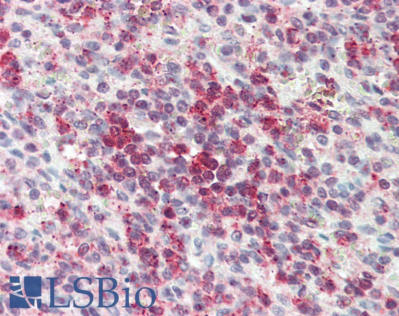 IHC-plus™ Polyclonal Rabbit anti-Human CYSLT2 / CYSLTR2 Antibody (C-Terminus, IHC)