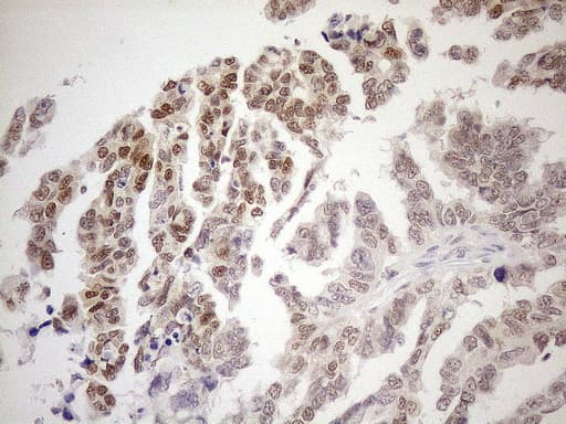 MGMT Antibody (clone OTI5A7)